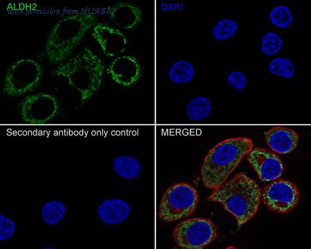 HUABIO M1509-1 image 2