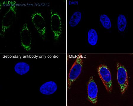 HUABIO M1509-1 image 3