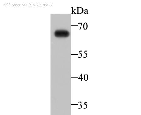 HUABIO M1510-30 image 1
