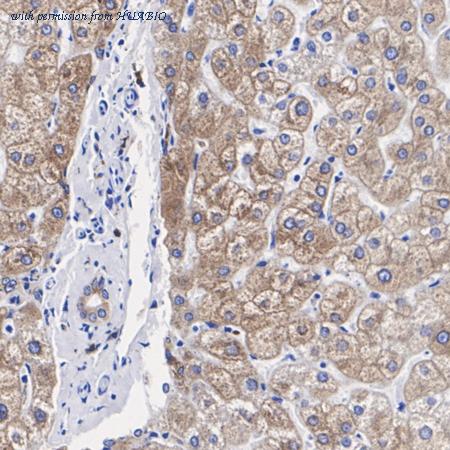 HUABIO M1701-12 image 2