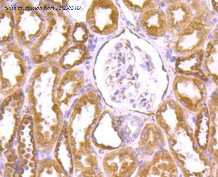 HUABIO M1701-12 image 3