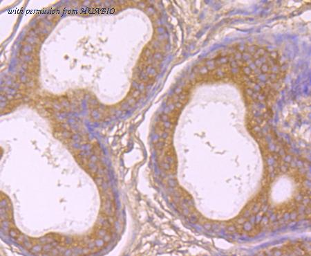 HUABIO M1701-13 image 2