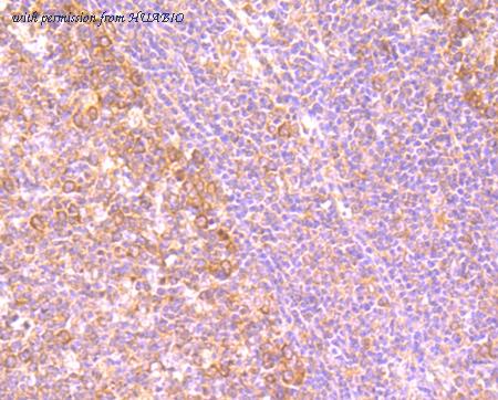 HUABIO M1701-13 image 3