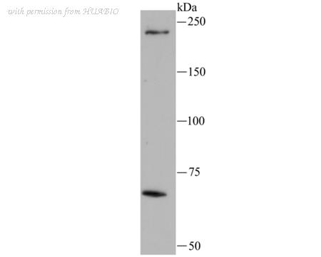 HUABIO M1701-14 image 1