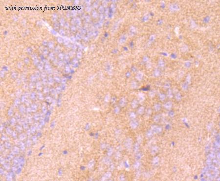 HUABIO M1701-14 image 2