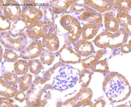 HUABIO M1701-14 image 3