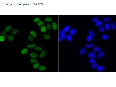 HUABIO R1210-2 image 2