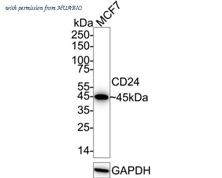 HUABIO R1303-1 image 1