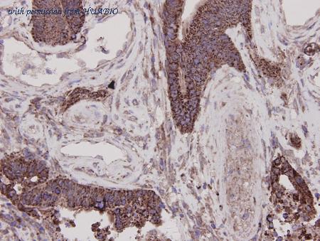 HUABIO R1303-1 image 2