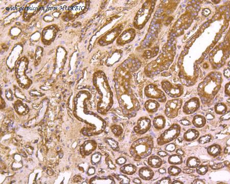 HUABIO R1308-16 image 2