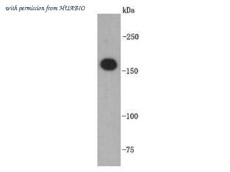 HUABIO R1310-2 image 1