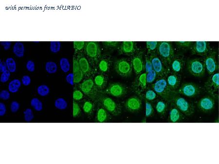 HUABIO R1310-2 image 2