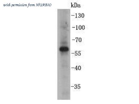 HUABIO R1311-4 image 1