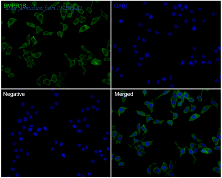 HUABIO R1311-4 image 2