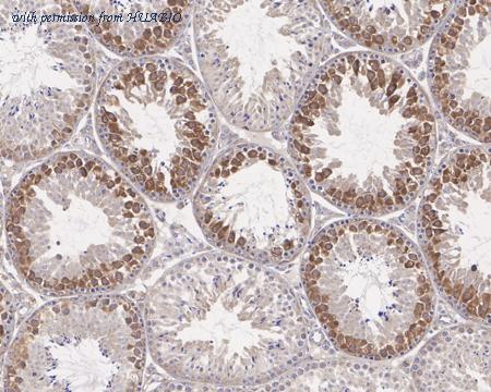 HUABIO R1311-8 image 3