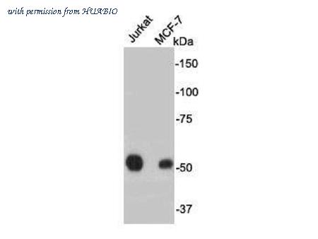 HUABIO R1401-14 image 1