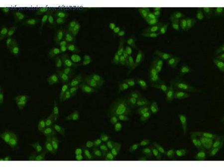 HUABIO R1403-2 image 2