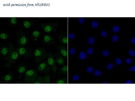 HUABIO R1411-3 image 2