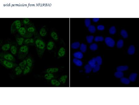 HUABIO R1411-3 image 3