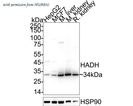 HUABIO R1411-4 image 1
