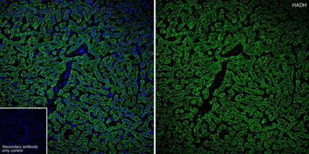 HUABIO R1411-4 image 2