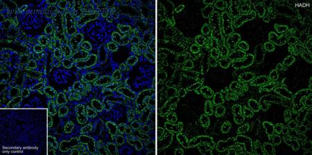 HUABIO R1411-4 image 3