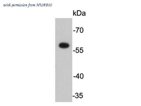 HUABIO R1501-3 image 1