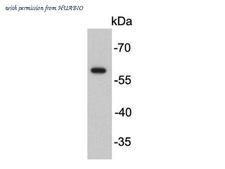 HUABIO R1501-4 image 1