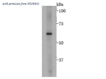 HUABIO R1510-1 image 1