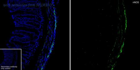 HUABIO R1510-28 image 1