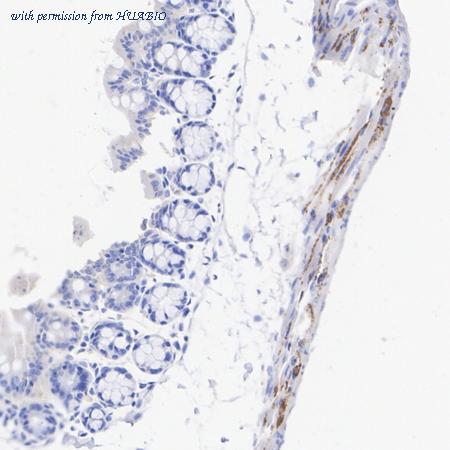 HUABIO R1510-28 image 3