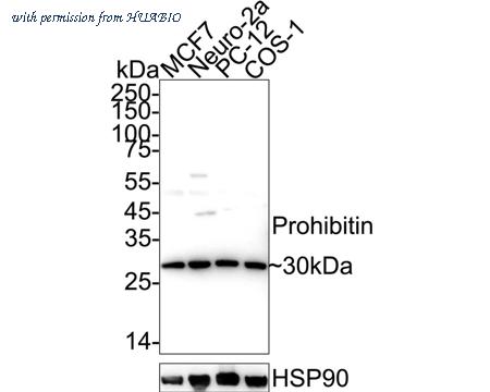 HUABIO R1510-30 image 1