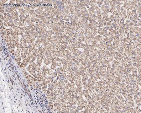 HUABIO R1510-30 image 2