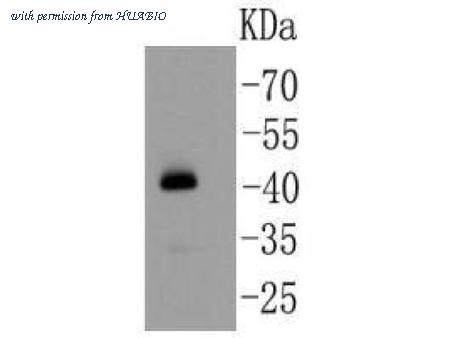 HUABIO R1510-36 image 1