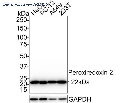 HUABIO R1510-37 image 1