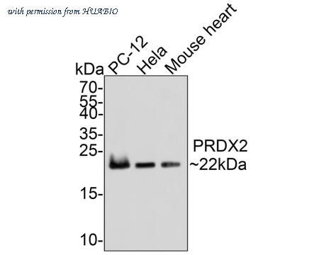 HUABIO R1510-37 image 2