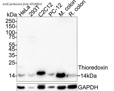 HUABIO R1511-16 image 1