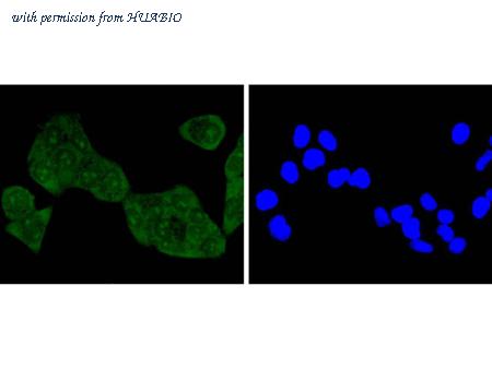 HUABIO R1511-31 image 3