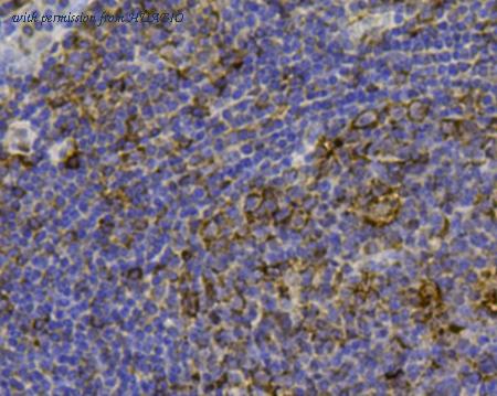 HUABIO R1511-35 image 3