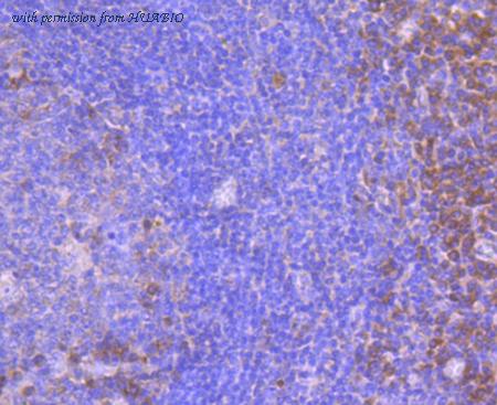 HUABIO R1511-36 image 2