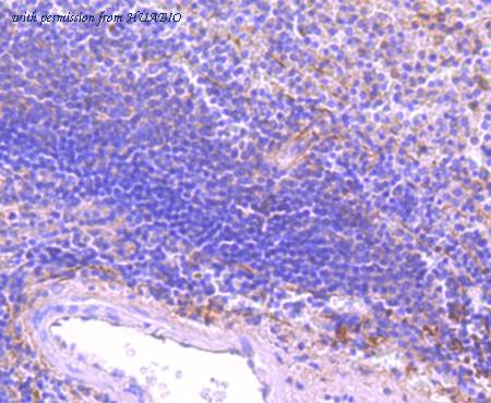 HUABIO R1511-36 image 3