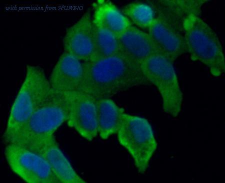 HUABIO R1512-13 image 2