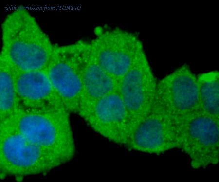 HUABIO R1512-16 image 2