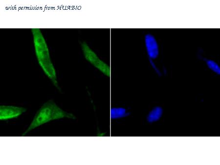 HUABIO R1706-21 image 3