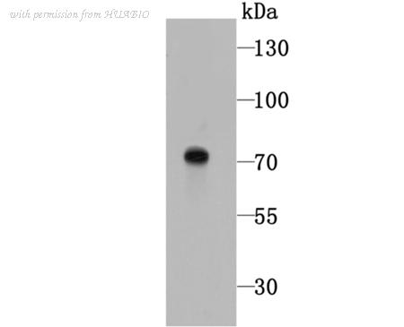 HUABIO R1706-4 image 2