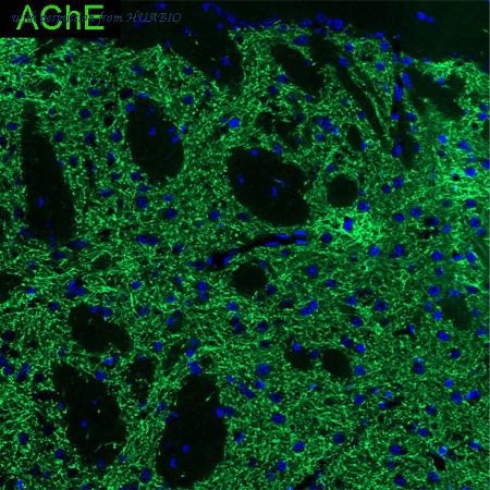 HUABIO HA601400 image 1