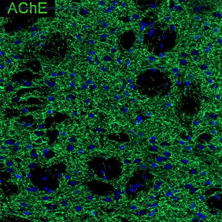 HUABIO HA601400 image 2