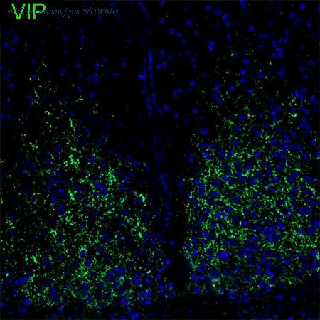 HUABIO HA601401 image 1