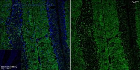 HUABIO HA601403 image 1