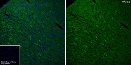 HUABIO HA601410 image 1